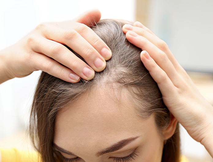 Hair Thinning and Loss